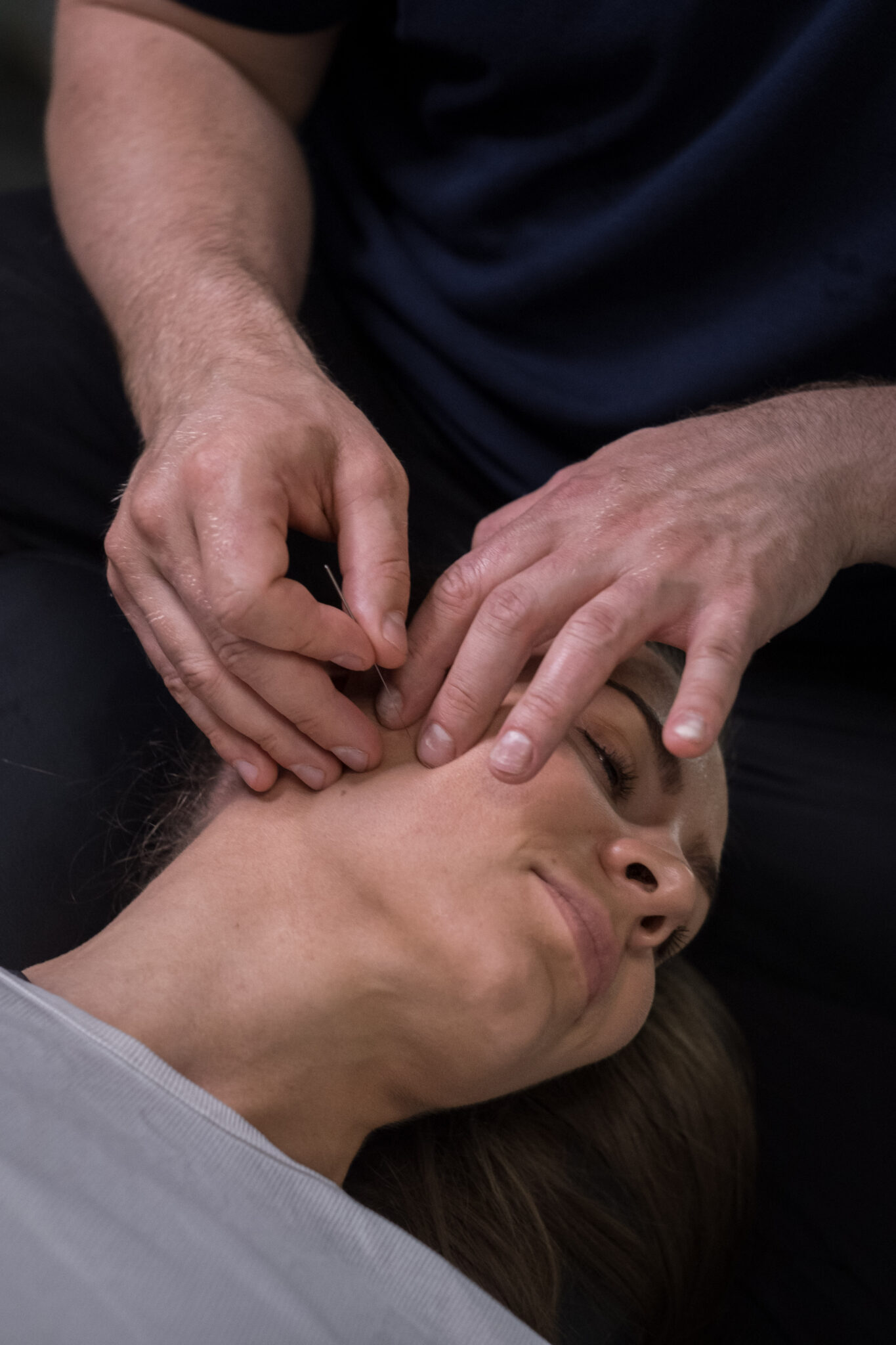 Pasient som mottar dry needling (tørrnålsbehandling) i masseter-muskelen for kjeveplager ved TMD-klinikken i Oslo.